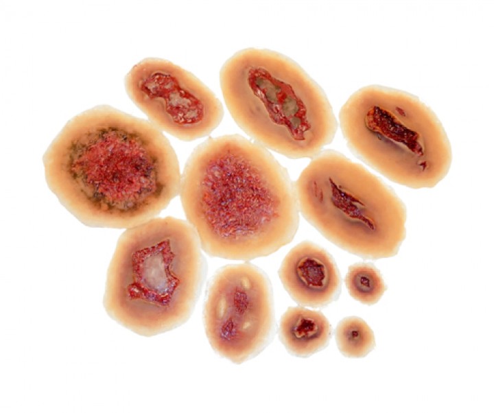 Zestaw samoprzylepnych ran (Techline - Self-Adhesive Wound Kit)